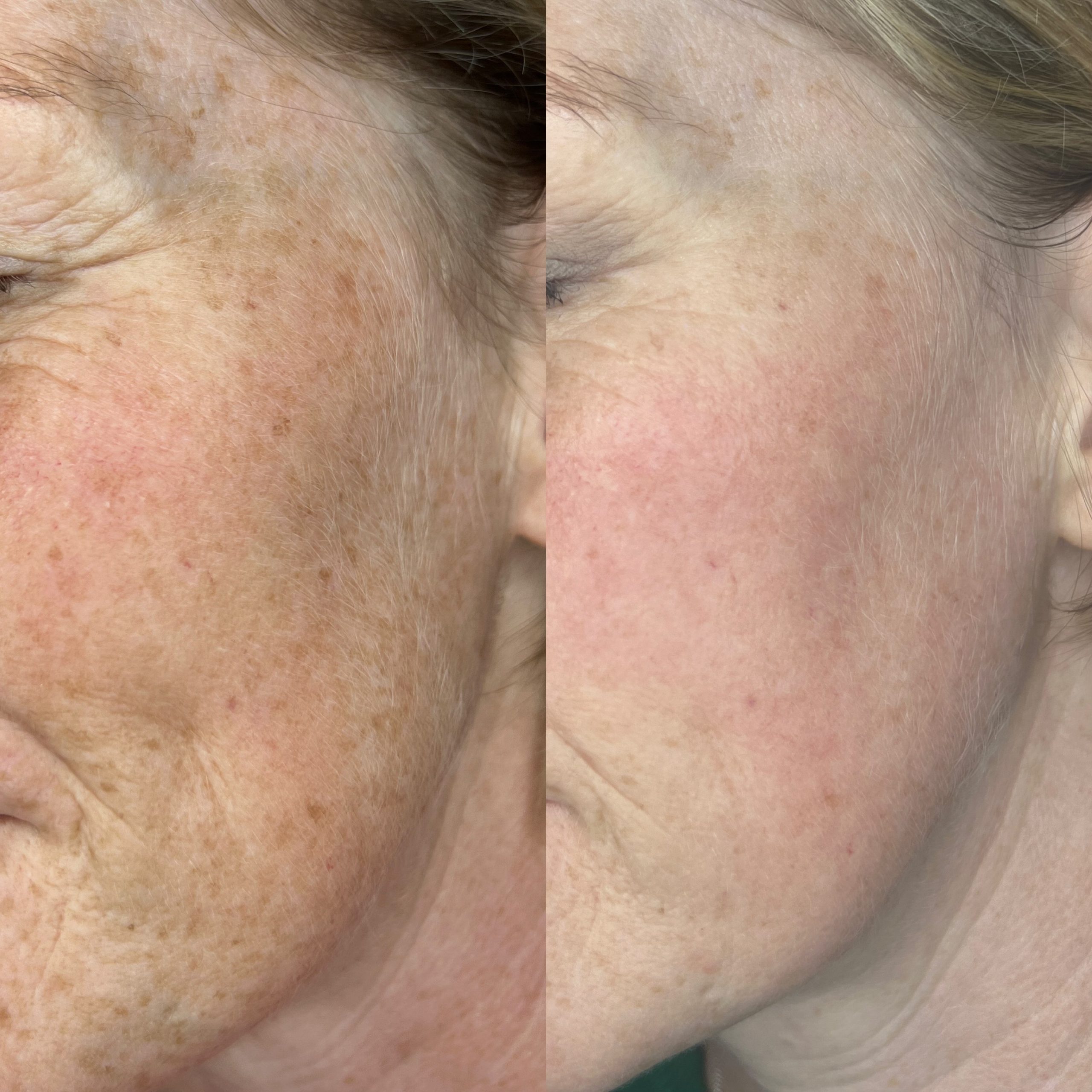 Benefit 2