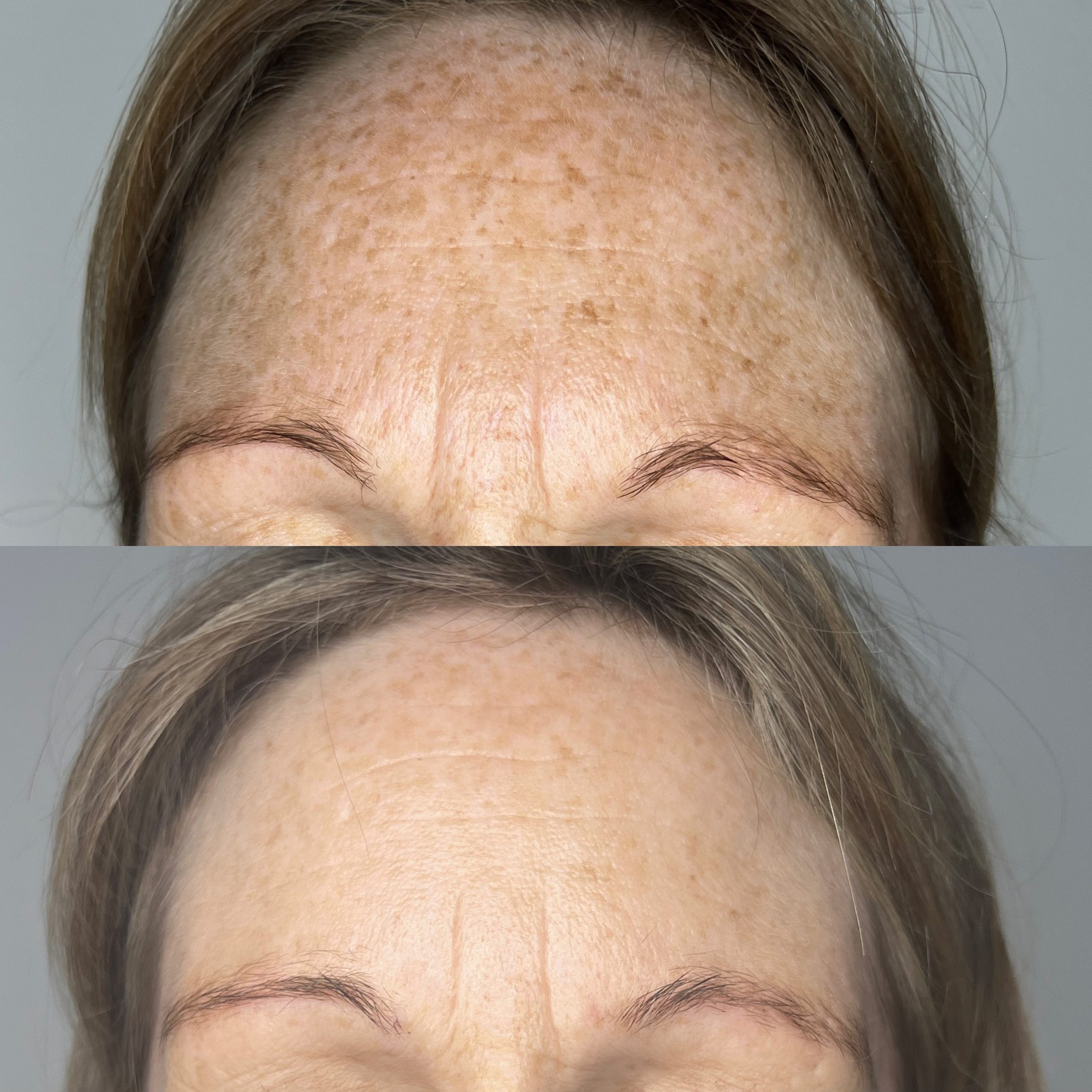 Benefit 3